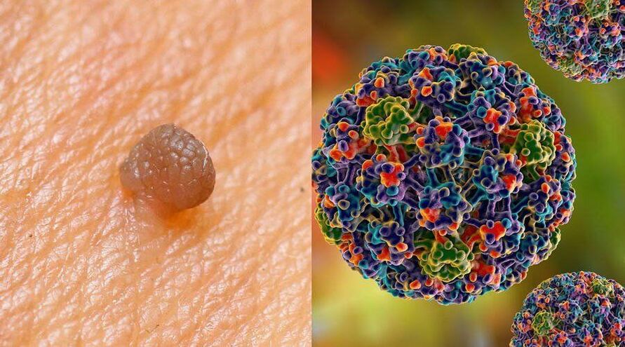 Пътища на предаване на HPV